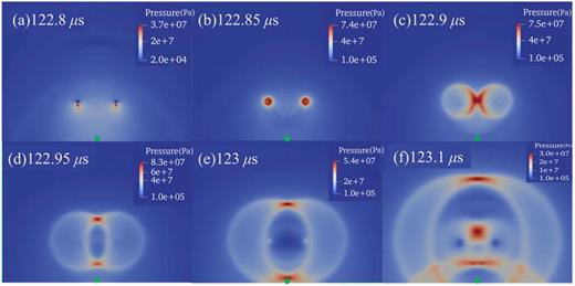 The mechanisms of jetting, vortex sheet, and vortex ring development in ...