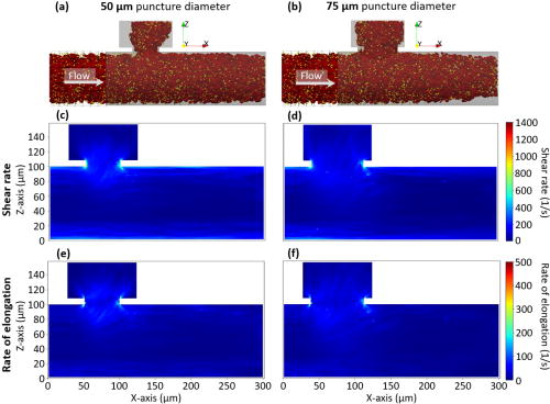 0 Pa pressure difference flow profiles in cross section. (a) and (b) Visualization of the simulations after 0.2 s, (c) and (d) cross-sectional shear rate profiles, and (e) and (f) cross-sectional elongation rate profiles for the 50 and 75 μm puncture diameter simulation, respectively, at a 0 Pa pressure difference between the outlets. The 50 μm puncture diameter simulation reaches peak shear rate values of 1091 s−1 and peak rate of elongation values of 423 s−1, while the 75 μm case reaches peak shear rate and rate of elongation values of 971 and 393 s−1, respectively. All results are time-averaged from 0.165 to 0.2 s in 0.005 s steps.