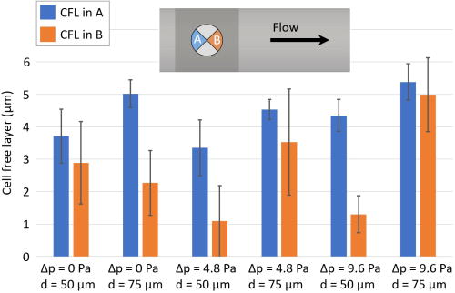 CFL width. CFL thickness in the proximal and distal wound neck volume quarters A and B. The top view layout sketch highlights the respective regions of interest. All results are time-averaged from 0.165 to 0.2 s in 0.005 s steps. The results include 50 and 75 μm puncture diameter simulations for pressure difference settings 0, 4.8, and 9.6 Pa.