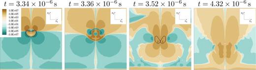 Solvent stress     τ  S , 12   ( Pa ) through the x2/x3-midplane for different time instants during the collapse for Re = 40 and initial standoff distance     h * = 1.5 in Newtonian fluid. Black isoline shows constant vapor content of    α = 0.01.
