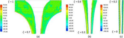 Vorticity ( Ωθ) in  r−z sectional plane for the Straight regime.