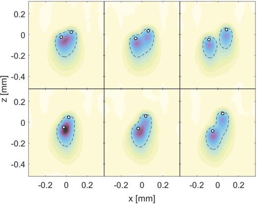 Changing ion wake structure in the vicinity of two charged dust grains (white circles). Darker shades indicate higher ion density. The dashed lines mark the contours where the ion density ni is 1.4 times greater than the background ion density     n  i 0    . Figure produced using the DRIAD code.178