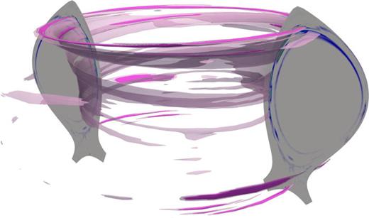 Poloidal tungsten density cross sections and contours of tungsten density during a quasi-steady-state part of a simulation. Solid Pink: highest W density. Transparent light pink: relatively high W density. Due to the applied 3D fields, W mostly tends to gather at the top and high-field side. However, a pronounced toroidally localized trapping takes place at the bottom of the pedestal right of the X-point.