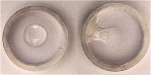 Reaction of titanium(IV) propoxide liquid with moisture from the air. On the left: titanium(IV) propoxide under dry air conditions; on the right: a droplet of titanium(IV) propoxide after 5 min of exposure to natural air , both contained in a 17 mm diameter glass crucible. Note that the humid air exposed sample has turned to chalky white, indicating the formation of TiO2 and loss of the original liquid structure.