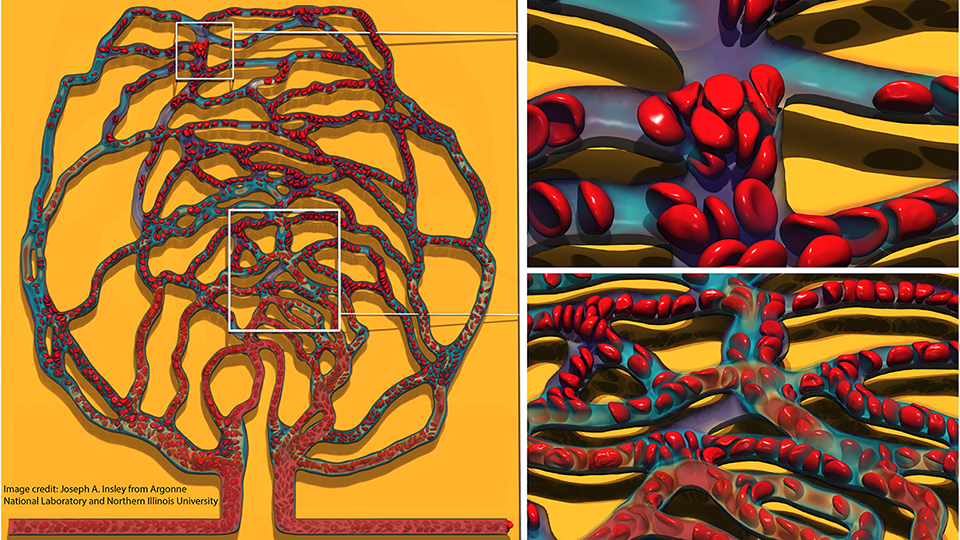 Capillary model tracks blood flow in healthy and diseased networks ...