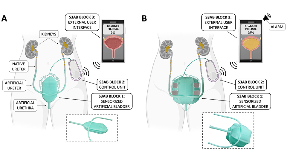 A completely soft bladder implant with Bluetooth capability | Scilight ...