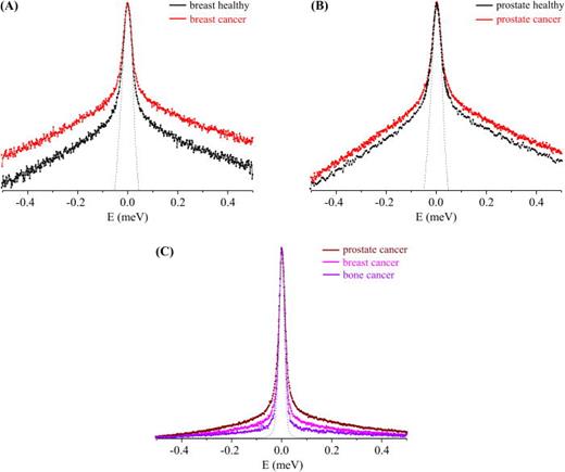 FIG. 1. QENS profiles (310 K, at Q = 1.684 Å−1) for cancer and healthy human cells: (a) breast cancer and breast healthy, (b) prostate cancer and prostate healthy, and (c) all cancer cells studied—breast, prostate, and bone (the spectra were normalized to the maximum peak intensity. The dashed line represents the instrument resolution, as measured by a standard vanadium sample. The QENS profiles (a) and (b) are represented in the yy´ logarithmic scale).