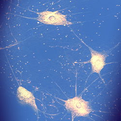 Special Collection Image